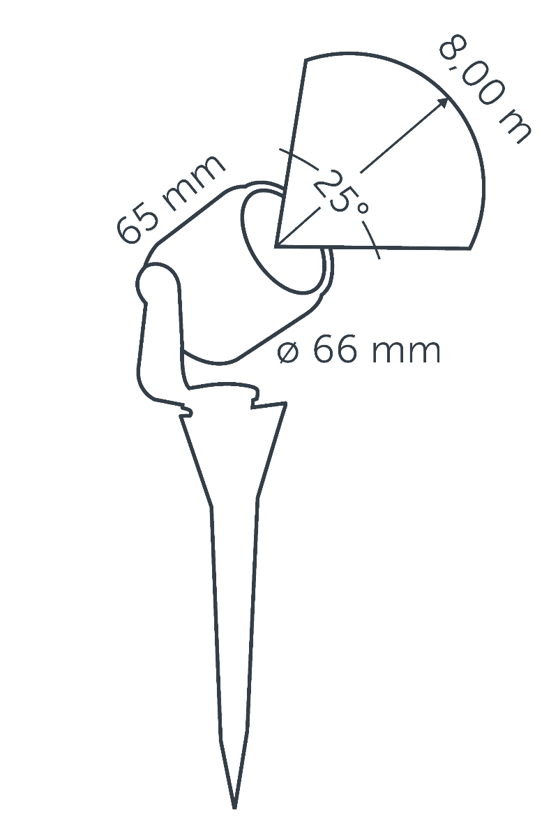 diagram of the scope spot light projection